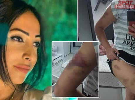 Annesi Sattı, Eşi “Aşkım” Demedi Diye Dövdü