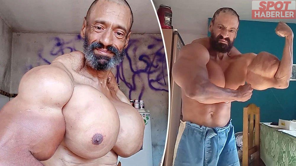 “Brezilyalı Hulk” Doğum Gününde Hayatını Kaybetti