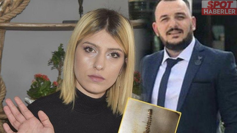 Eşini 38 yerinden bıçaklayan erkek, çocuklarını görmekten men edildi