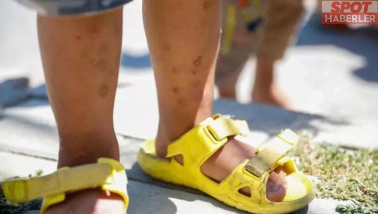 İstanbul’da “Aedes” Sivrisineği Tehdidi! Uzman İsim Açıklamalarıyla Korkuttu!