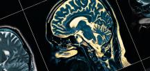 Bilim insanlarının yeni keşfi: Beynin her hücresini yenileyen mucize vitamin, Alzheimer’a yeni çare mi?