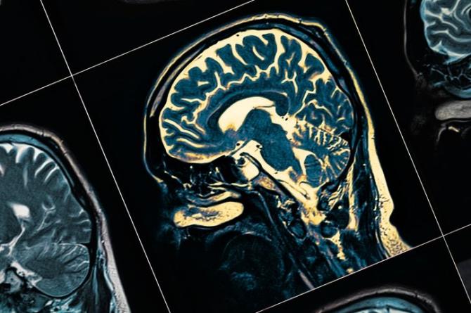 Bilim insanlarının yeni keşfi: Beynin her hücresini yenileyen mucize vitamin, Alzheimer’a yeni çare mi?