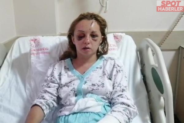 Feci şekilde dövülen genç kadın 5 gün sonra gözlerini açtı!
