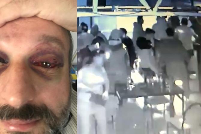 Bursa’da ‘istek parça’ dehşeti! 10 saldırgan, müzisyeni öldüresiye dövdü