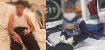 Son Dakika! Bitlis’te sokak köpeğinin ısırdığı ve kuduz olan çocuk hayatını kaybetti