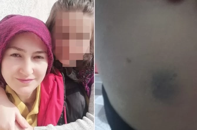 Şiddet gören kadının yardım çığlığı