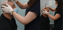 Dr. Ayşe Aslan, saç ekimi alanında başarıyla hizmet veriyor
