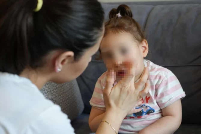 Özel Kreşte Şiddet Skandalı!