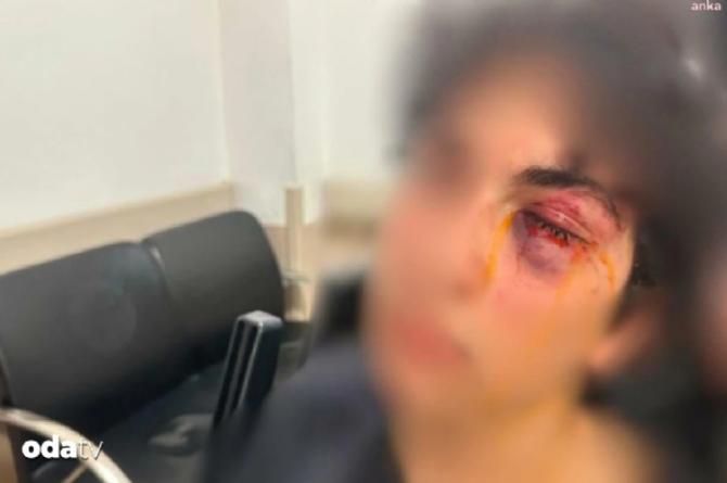 CHP standına saldırı: 15 yaşındaki çocuğu öldüresiye darbettiler