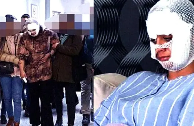 “Seni Bergen Gibi Yapacağım” Diyerek Eşini Bıçakladı