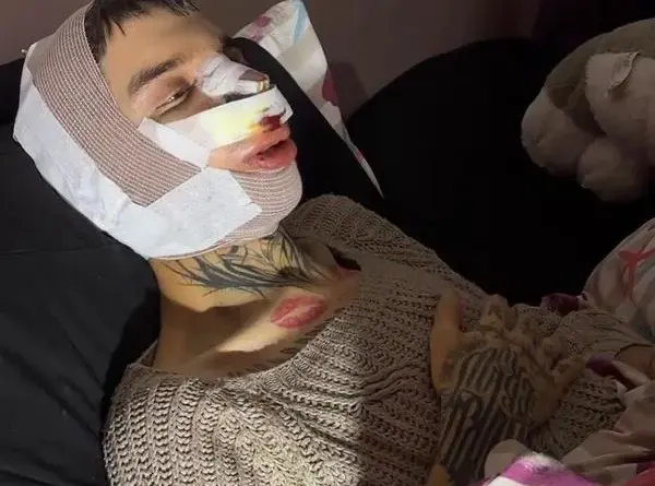 ‘Tablet Reis’ estetik ameliyat oldu