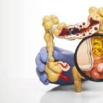 Bağırsak sağlığını tehdit eden 5 besin grubu