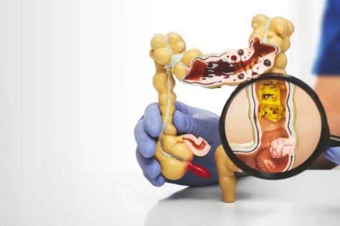 Bağırsak sağlığını tehdit eden 5 besin grubu