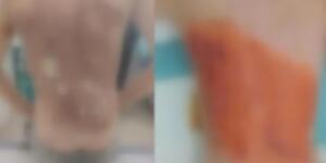 Dehşete düşüren akran zorbalığı! 12 yaşındaki çocuğa kolonya döküp ateşe verdiler